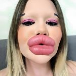 The individual boasting the largest lips on the planet!