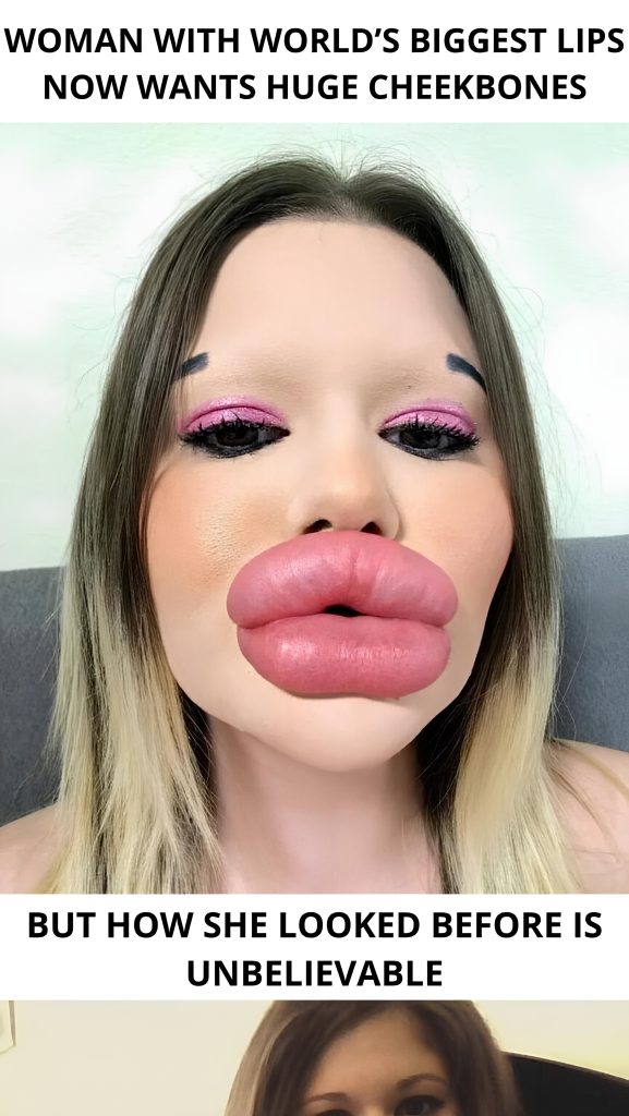 The individual boasting the largest lips on the planet!